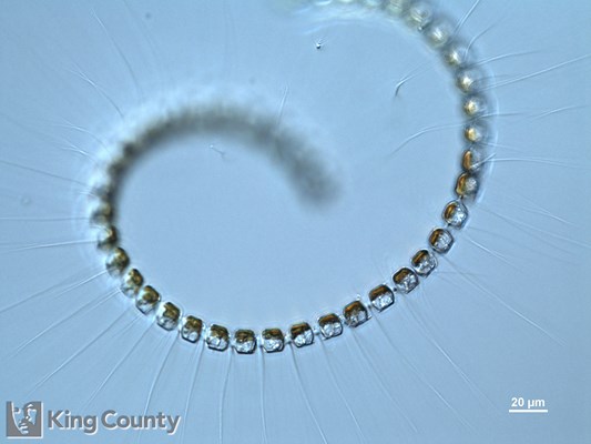Photo of Chaetoceros debilis